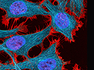 Bioprocess Engineering